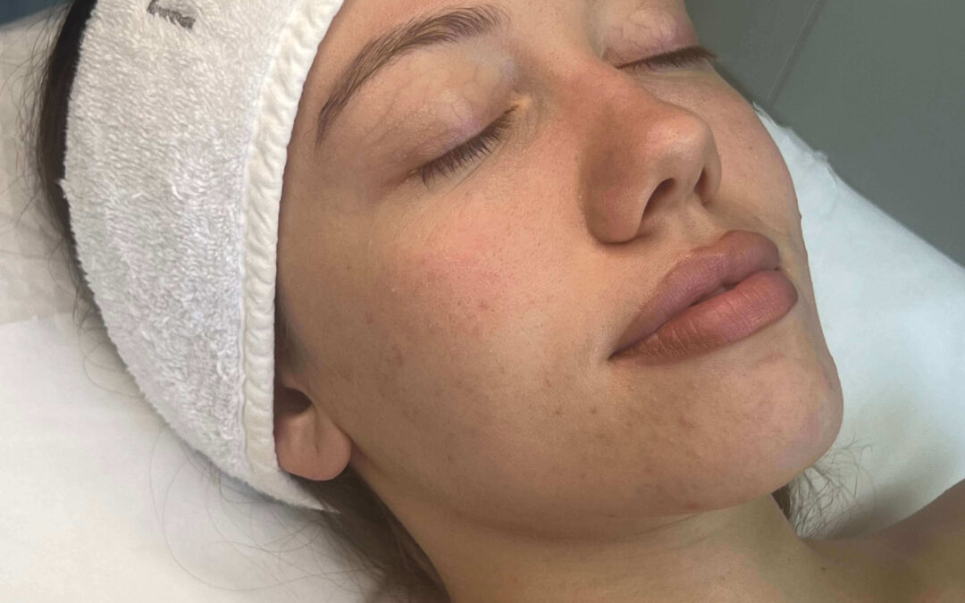 Почистване на лице Бургас – Как да изберете правилната процедура | Derma Aesthetic