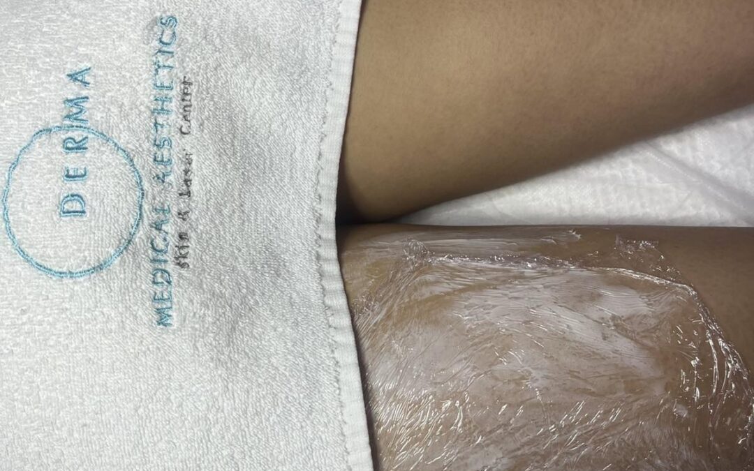 Bodyshock – нова процедура за оформяне на тялото в DERMA Center